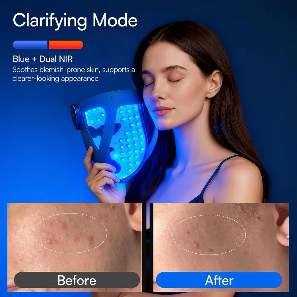 Wireless Red Light Therapy Mask